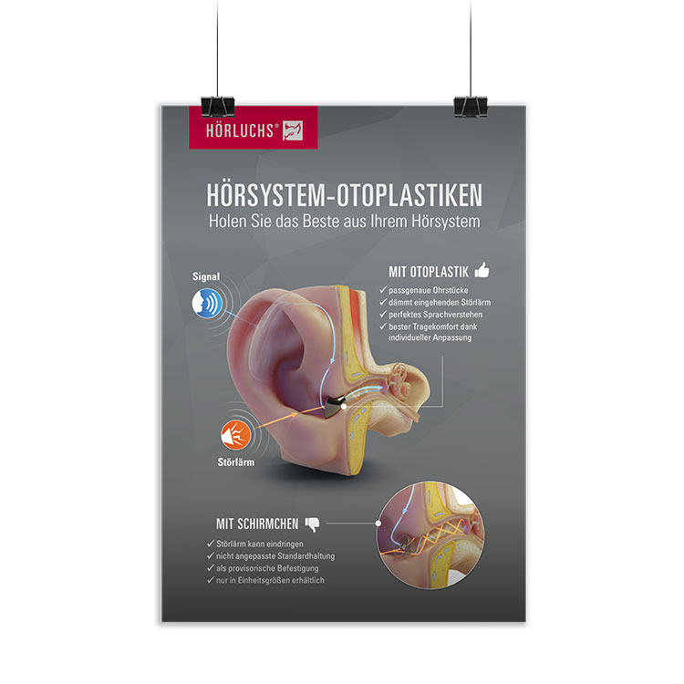 Hörluchs® Plakat Otoplastik-Schirmchen-Vergleich