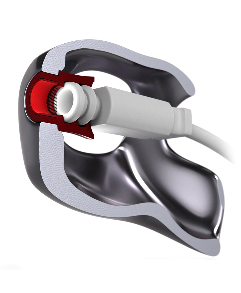 Hörluchs® UNIRIC-Otoplastik aus 3D TITAN